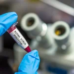 The specter of "Nipah" haunts Asia... A deadly virus that kills 75% of those infected puts airports on high alert